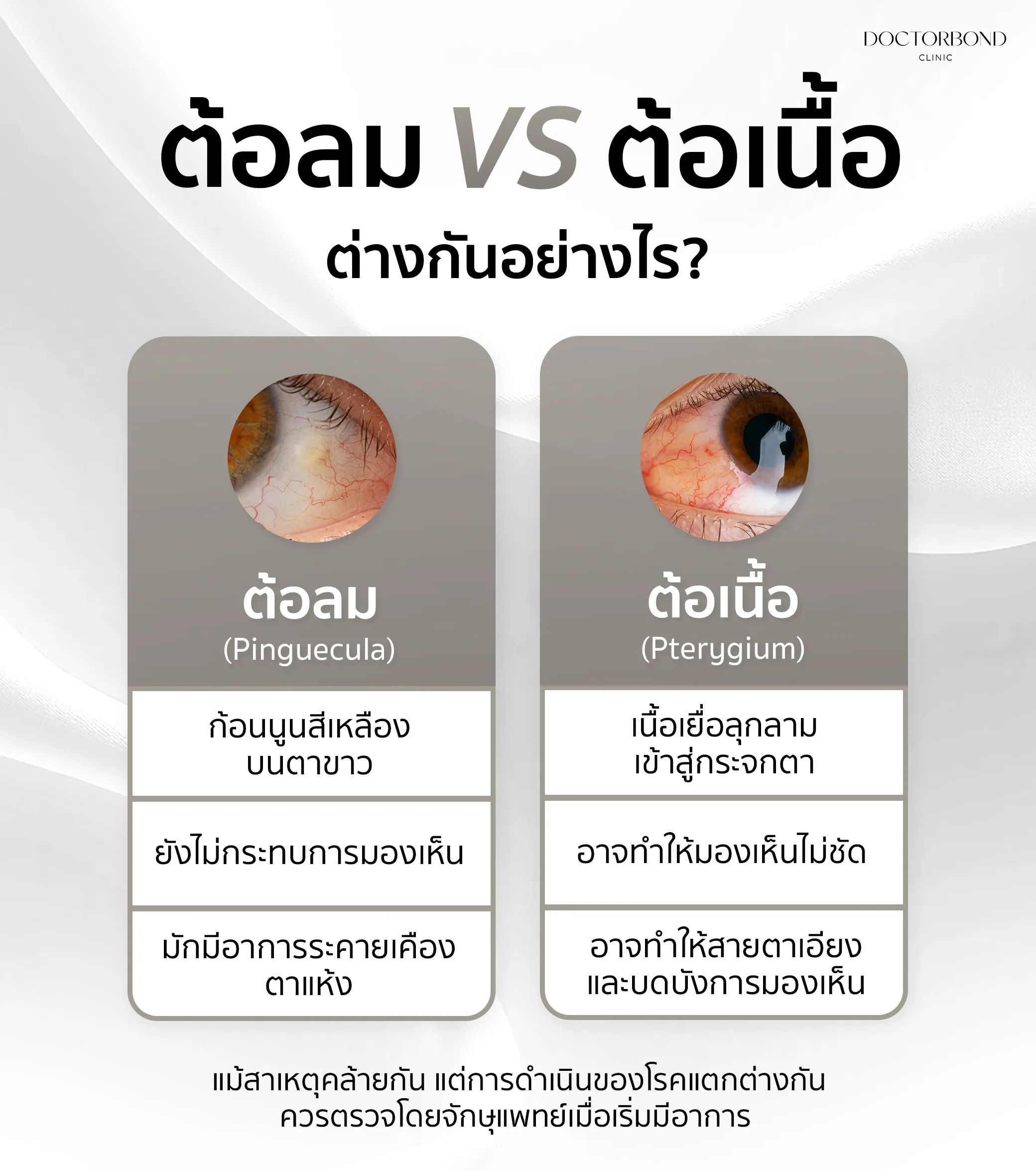ต้อลม