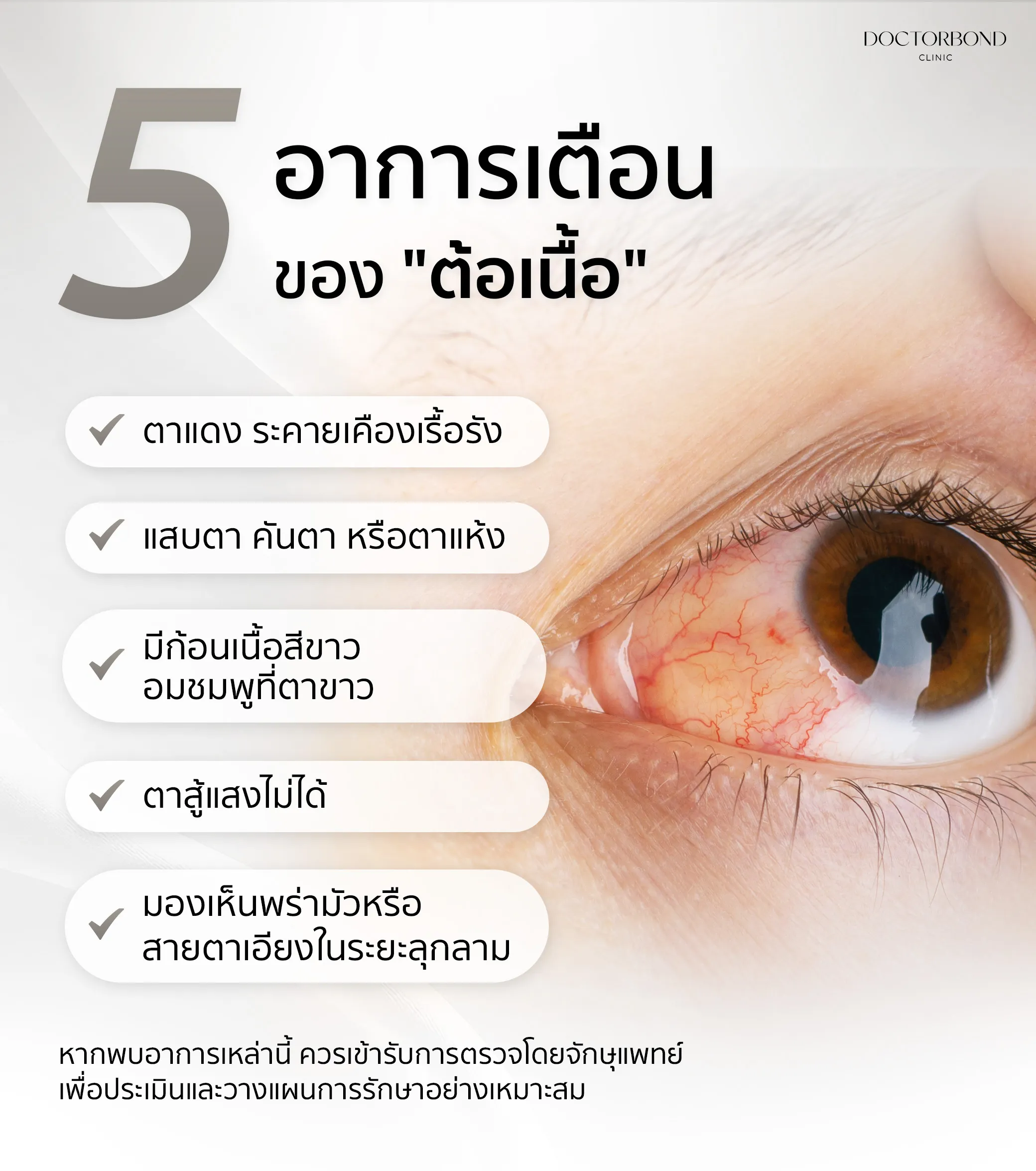 ต้อเนื้อ
