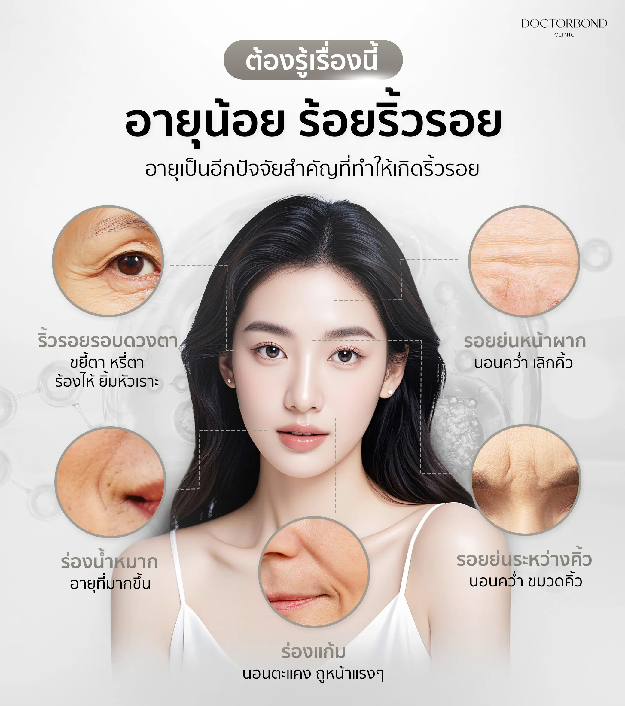 BOTOX Allergan