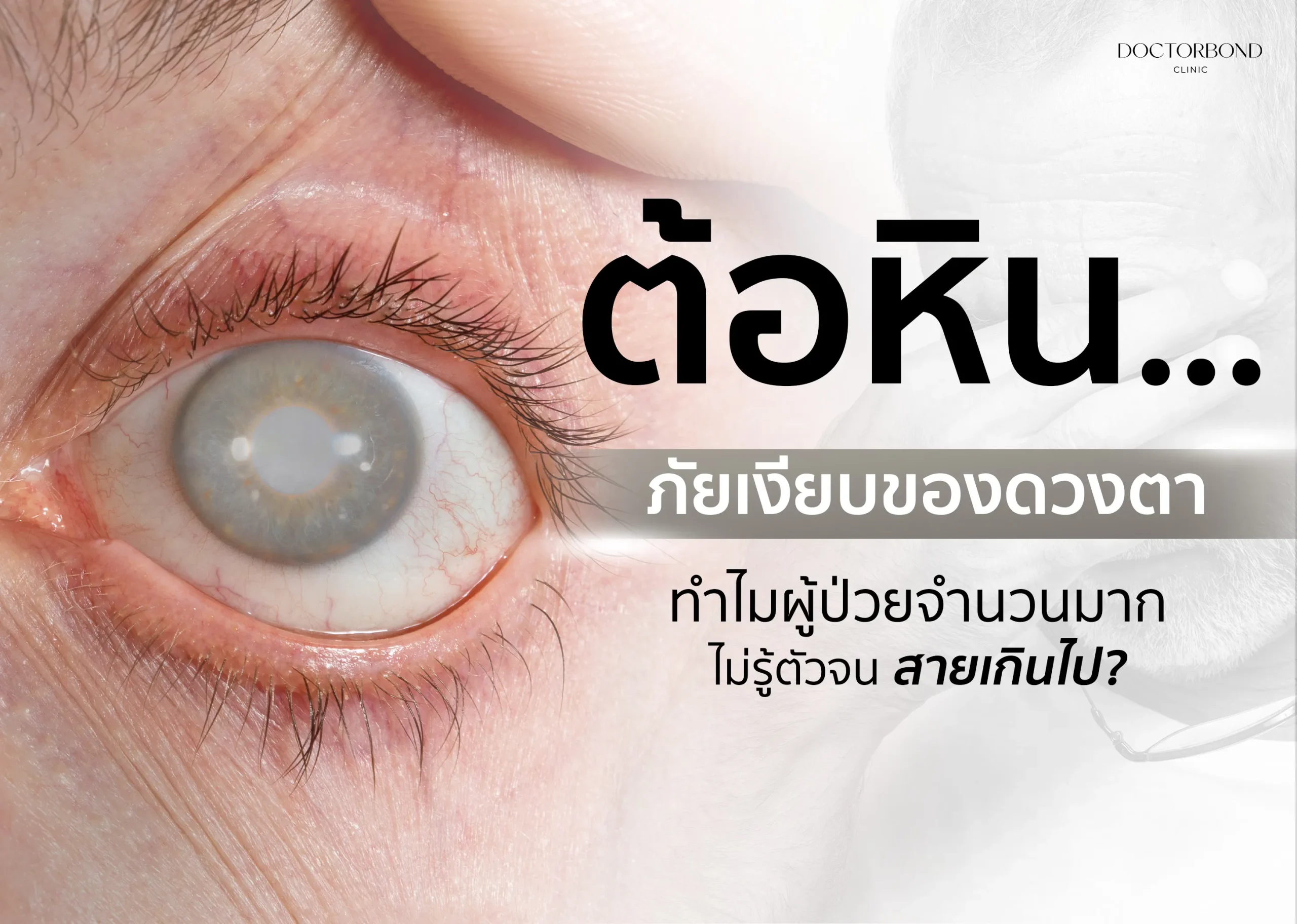 ต้อหิน