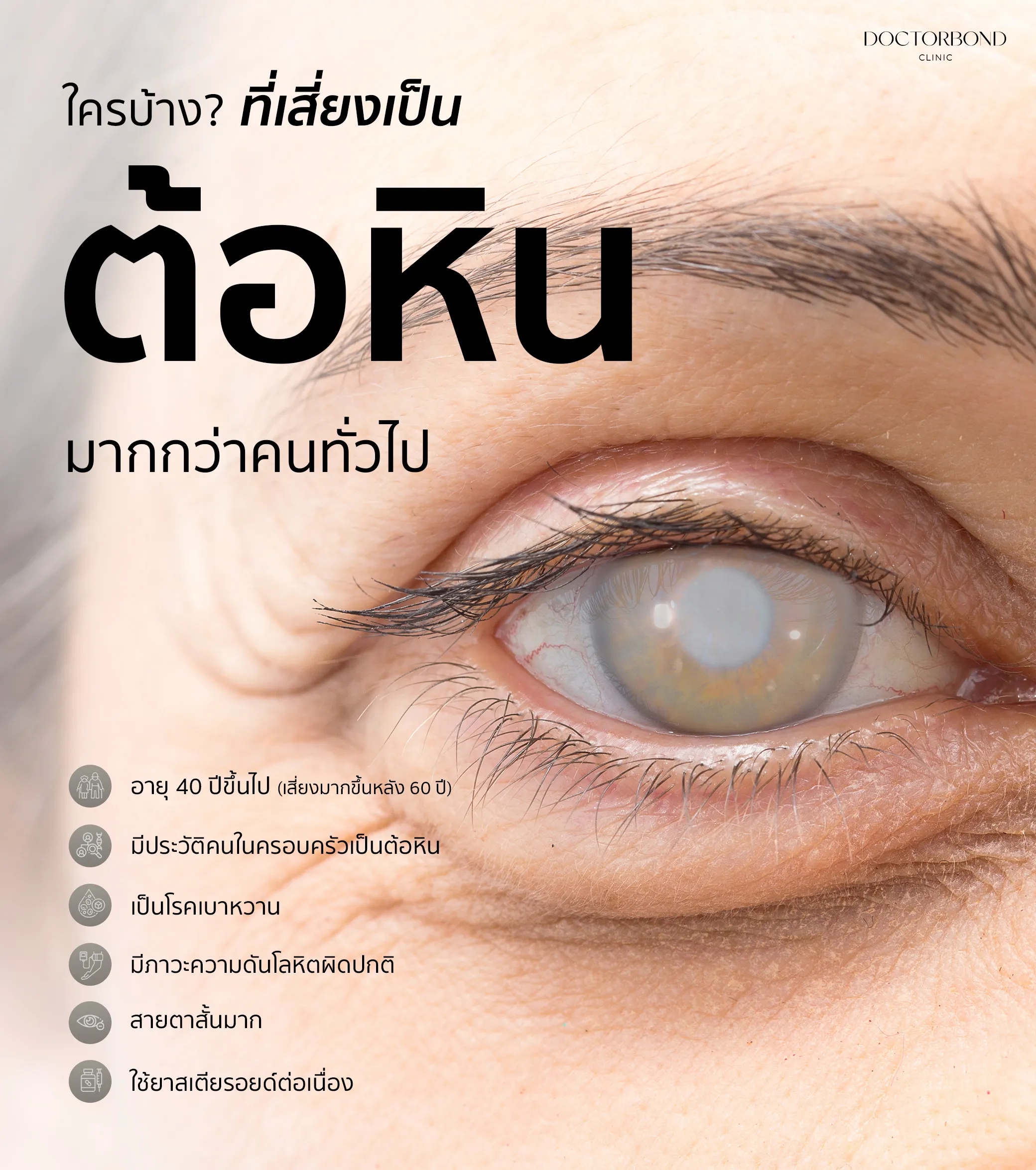 ต้อหิน